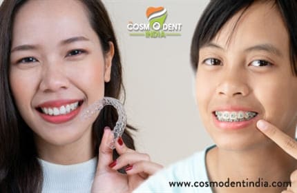 how-is-invisalign-better-than-braces