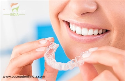 how-much-does-it-cost-to-get-invisalign