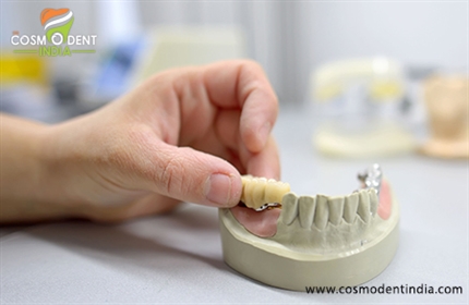 dental-bridge-procedure-cost