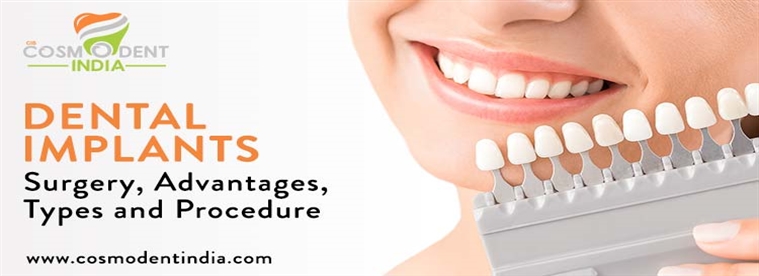 dental-implants-surgery-advantages-types-and-procedure
