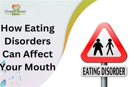 摂食障害が口に与える影響