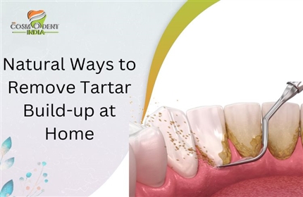 家庭での歯石の蓄積を自然に取り除く方法