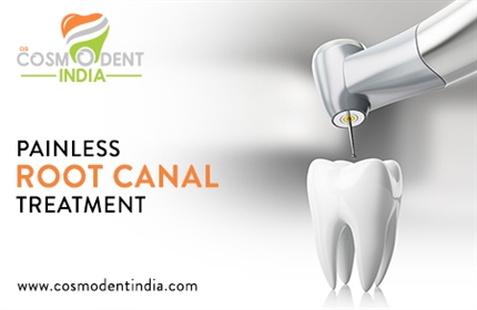 painless-root-canal-treatment-in-bangalore
