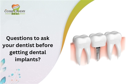 歯科インプラントを受ける前に歯科医に尋ねる質問