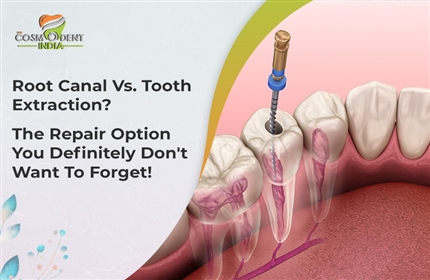 endodoncia vs. extracción dental-la-opción-de-reparación-que-definitivamente-no-quieres-olvidar