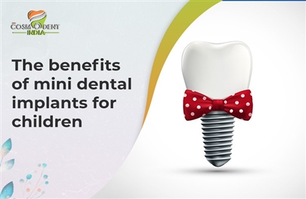 los-beneficios-de-los-mini-implantes-dentales-para-niños