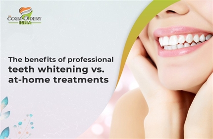 プロの歯のホワイトニングと自宅での治療のメリット