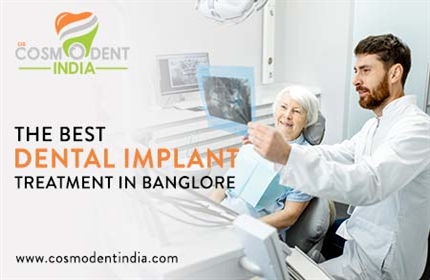 बेंगलुरु में सबसे अच्छा-दंत-प्रत्यारोपण-उपचार