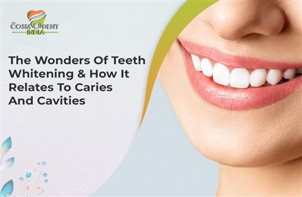 歯の不思議 - ホワイトニング - 齲蝕と虫歯の関係