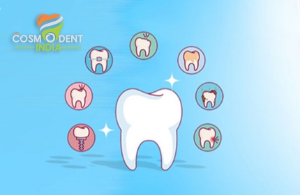 mejores tratamientos dentales en Bangalore