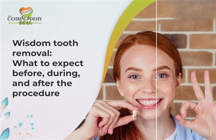 wisdom-tooth-removal-what-to-expect-before-during-and-after-the-procedure