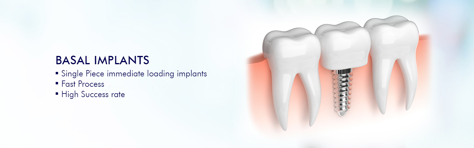 permanent-teeth-with-basal-implants-in-india