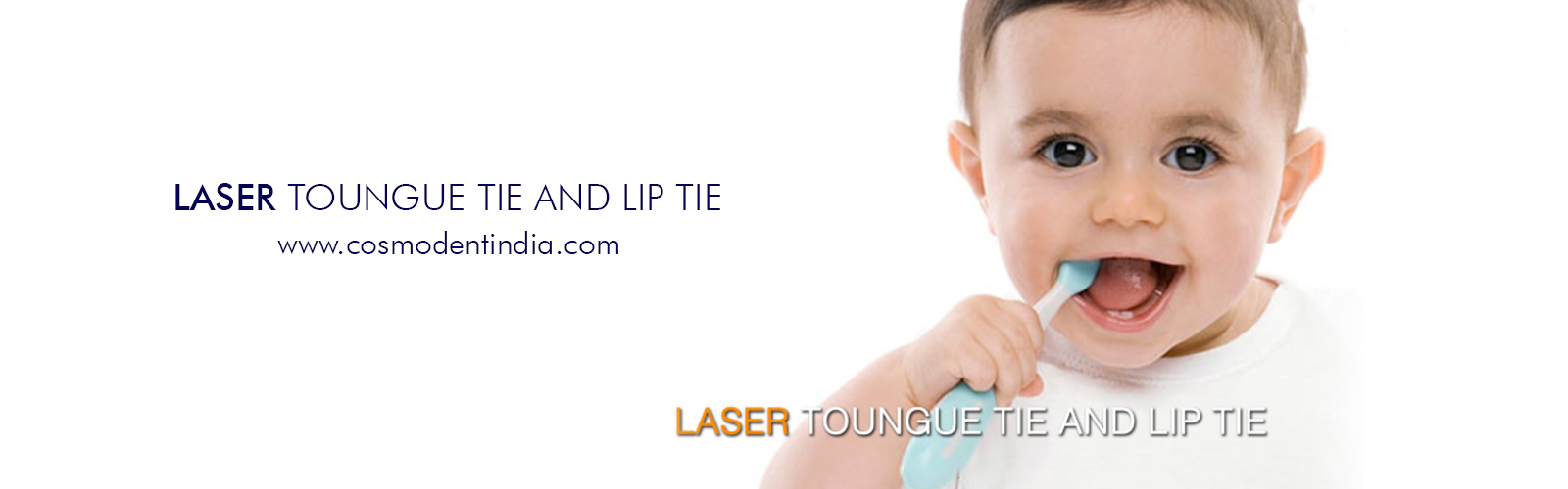 laser-toungue-tie-and-lip-tie