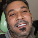 歯列矯正治療インド