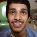 歯のホワイトニングコスト - インド